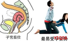 子宫后位如何怀孕,子宫后位女性如何提高怀孕成功率
